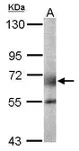 Anti-GALNT2 antibody used in Western Blot (WB). GTX104070